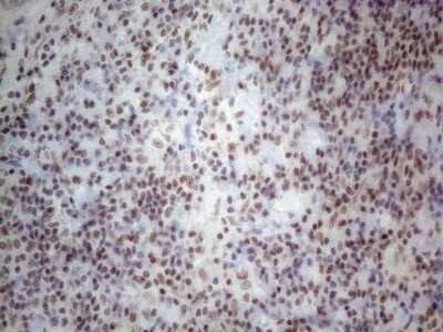 Immunohistochemistry: TR4/NR2C2 Antibody (OTI4B1) [NBP2-46228]
