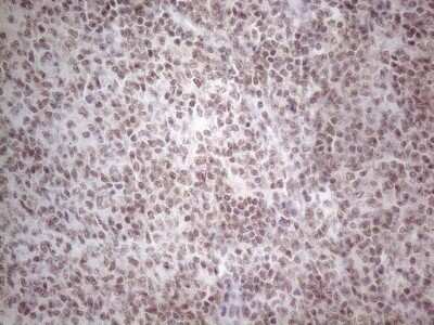 Immunohistochemistry: TR4/NR2C2 Antibody (OTI4B1) [NBP2-46228]