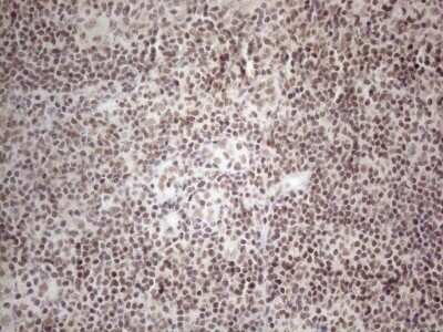 Immunohistochemistry: TR4/NR2C2 Antibody (OTI4B1) [NBP2-46228]