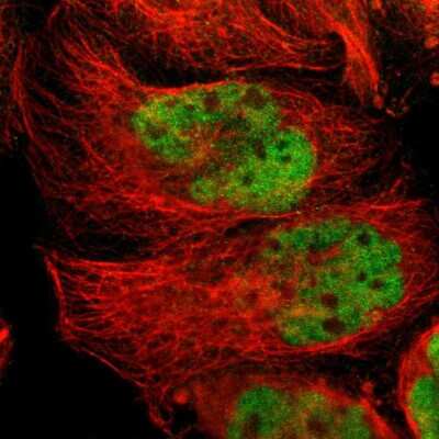 Immunocytochemistry/ Immunofluorescence: TR4/NR2C2 Antibody [NBP1-81658]