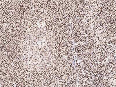 Immunohistochemistry-Paraffin: TR4/NR2C2 Antibody [NBP2-97138]