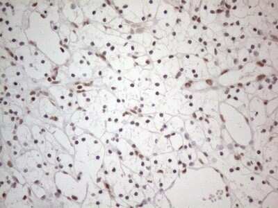 Immunohistochemistry: TR4/NR2C2 Antibody (OTI4B1) - Azide and BSA Free [NBP2-74577]