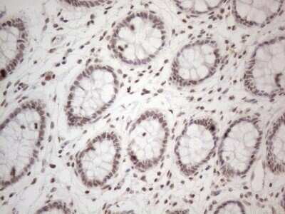 Immunohistochemistry: TR4/NR2C2 Antibody (OTI4B1) - Azide and BSA Free [NBP2-74577]