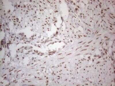 Immunohistochemistry: TR4/NR2C2 Antibody (OTI4B1) - Azide and BSA Free [NBP2-74577]