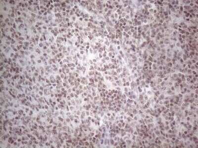 Immunohistochemistry: TR4/NR2C2 Antibody (OTI4B1) - Azide and BSA Free [NBP2-74577]