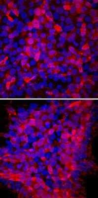 Immunocytochemistry/ Immunofluorescence: TRA-1-60(R) Antibody (TRA-1-60) - Azide and BSA Free [NBP2-80985]