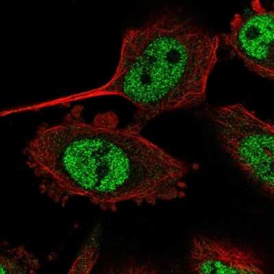 Immunocytochemistry/ Immunofluorescence: TRA16 Antibody [NBP2-55864]