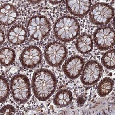 Immunohistochemistry-Paraffin: TRA16 Antibody [NBP1-92526]