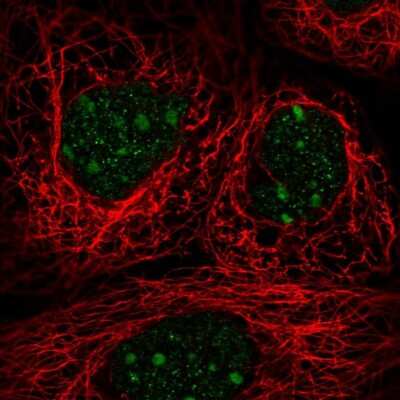 Immunocytochemistry/ Immunofluorescence: TRA2A Antibody [NBP2-13473]