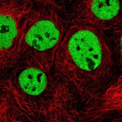 Immunocytochemistry/ Immunofluorescence: TRA2B Antibody [NBP2-49399]