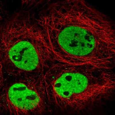 Immunocytochemistry/ Immunofluorescence: TRA2B Antibody [NBP2-57661]