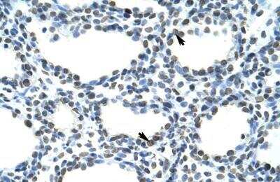 Immunohistochemistry-Paraffin: TRA2B Antibody [NBP1-57456]