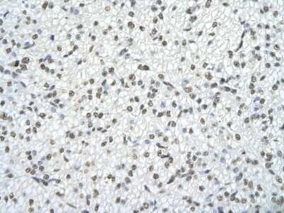 Immunohistochemistry-Paraffin: TRA2B Antibody [NBP1-57456]