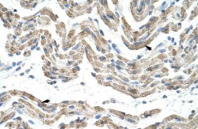 Immunohistochemistry-Paraffin: TRA2B Antibody [NBP1-57457]