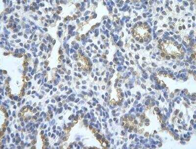 Immunohistochemistry-Paraffin: TRA2B Antibody [NBP1-57457]