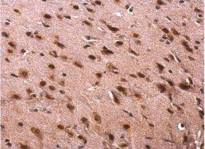 Immunohistochemistry-Paraffin: TRA2B Antibody [NBP2-15143]