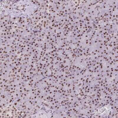 Immunohistochemistry-Paraffin: TRA2B Antibody [NBP2-49399]