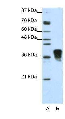 Western Blot: TRA2B Antibody [NBP1-57456]