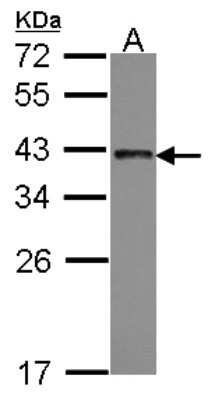 Western Blot: TRA2B Antibody [NBP2-15143]