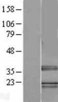 Western Blot: TRA2B Overexpression Lysate [NBL1-15887]