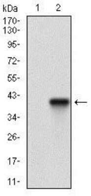 Western Blot: TRACP/PAP/ACP5 Antibody (5C5E7)BSA Free [NBP2-37362]