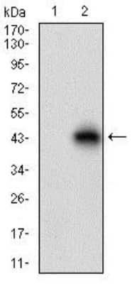 Western Blot: TRACP/PAP/ACP5 Antibody (7E6A11)BSA Free [NBP2-37337]