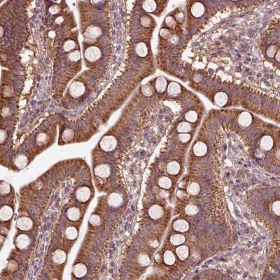Immunohistochemistry: TRADD Antibody [NBP2-68918]
