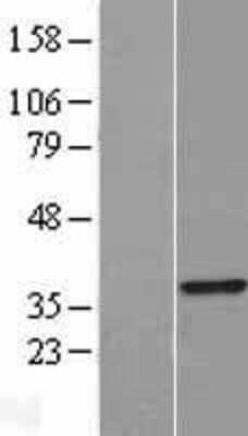 Western Blot: TRADD Overexpression Lysate [NBL1-17238]