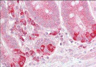 Immunohistochemistry-Paraffin: TRAF-1 Antibody [NB100-2822]