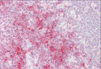 Immunohistochemistry-Paraffin: TRAF-1 Antibody [NB100-2822]