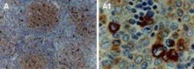 Immunohistochemistry-Paraffin: TRAF-1 Antibody [NB100-56170]
