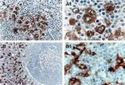 Immunohistochemistry-Paraffin: TRAF-1 Antibody [NB100-56170]
