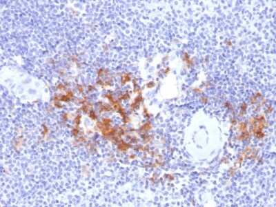 Immunohistochemistry-Paraffin: TRAF-1 Antibody (TRAF1/2770) [NBP2-79790]