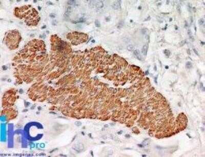 Immunocytochemistry: TRAF-2 Antibody (33A1293) - Azide and BSA Free [NBP2-80987]