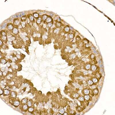 Immunohistochemistry-Paraffin: TRAF-2 Antibody - BSA Free [NBP3-03438]