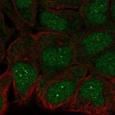 Immunocytochemistry/ Immunofluorescence: TRAF-4 Antibody [NBP3-17200]