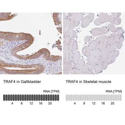 Immunohistochemistry-Paraffin: TRAF-4 Antibody [NBP2-33647]