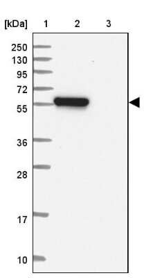 Western Blot: TRAF-4 Antibody [NBP2-33647]