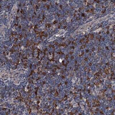 Immunohistochemistry-Paraffin: TRAFD1 Antibody [NBP1-81874]