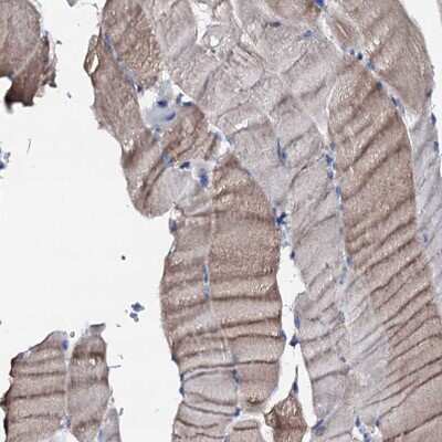 Immunohistochemistry-Paraffin: TRAFD1 Antibody [NBP1-81874]