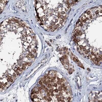 Immunohistochemistry-Paraffin: TRAFD1 Antibody [NBP1-81874]