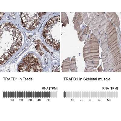 Immunohistochemistry-Paraffin: TRAFD1 Antibody [NBP1-81874]