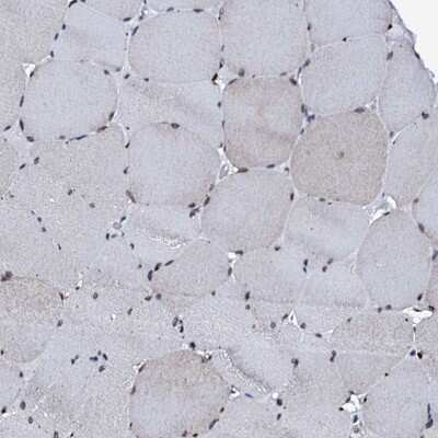 Immunohistochemistry-Paraffin: TRAFD1 Antibody [NBP1-81875]