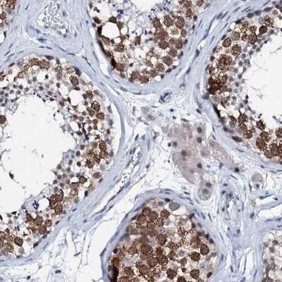 Immunohistochemistry-Paraffin: TRAFD1 Antibody [NBP1-81875]