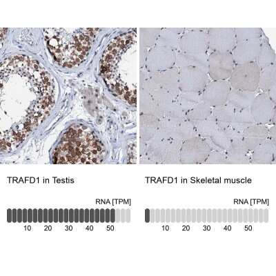 Immunohistochemistry-Paraffin: TRAFD1 Antibody [NBP1-81875]