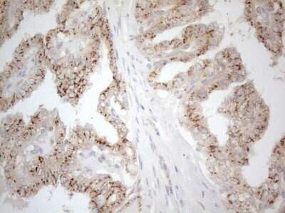 Immunohistochemistry: TRAILR2/TNFRSF10B Antibody (OTI2A5) [NBP2-46148]