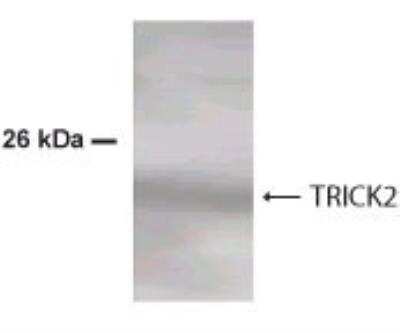 Western Blot: TRAILR2/TNFRSF10B Antibody [NBP2-24388]