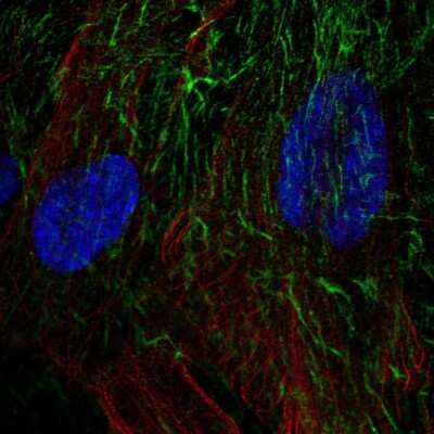 Immunocytochemistry/ Immunofluorescence: TRAILR4/TNFRSF10D/DcR2 Antibody [NBP2-57993]