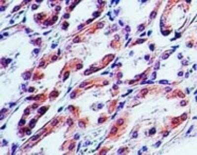 Immunohistochemistry: TRAIL/TNFSF10 Antibody (55B709.3) - Azide and BSA Free [NBP2-80989]