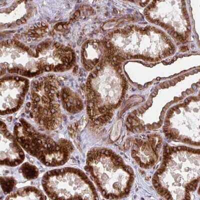 Immunohistochemistry-Paraffin: TRAIL/TNFSF10 Antibody [NBP2-38744]